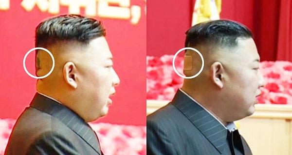 Kuzey Kore'nin lideri Kim Jong Un, geçtiğimiz hafta halka açık etkinlikler sırasında başının arkasında koyu bir nokta ile halkının karşısına çıktı.