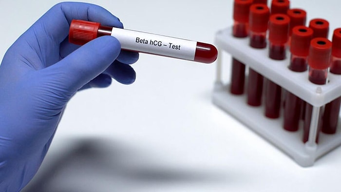 1 Haftalık Gebelikte Beta HCG Değeri Kaç Olmalı?