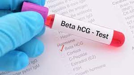 BETA HCG Nedir? BETA HCG  Değerleri Kaç Olmalıdır?