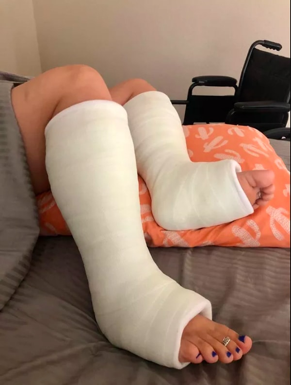 2. «Зачем ломать одну, если я могу сломать обе?»