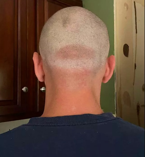 5. "У мужа первый рабочий день сегодня куда он пошел в кепке.Маленькие проблемы лысых... "