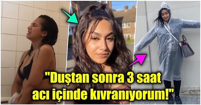 Banyo Yapmak Bir Lüks! Suya Alerjisi Olan Genç Kadının Kırk Yıl Düşünseniz Aklınıza Gelmeyecek Duş Rutini