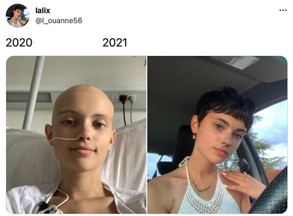 Ardından da 2021 yılında kanseri yendikten sonraki fotoğrafını paylaştı.