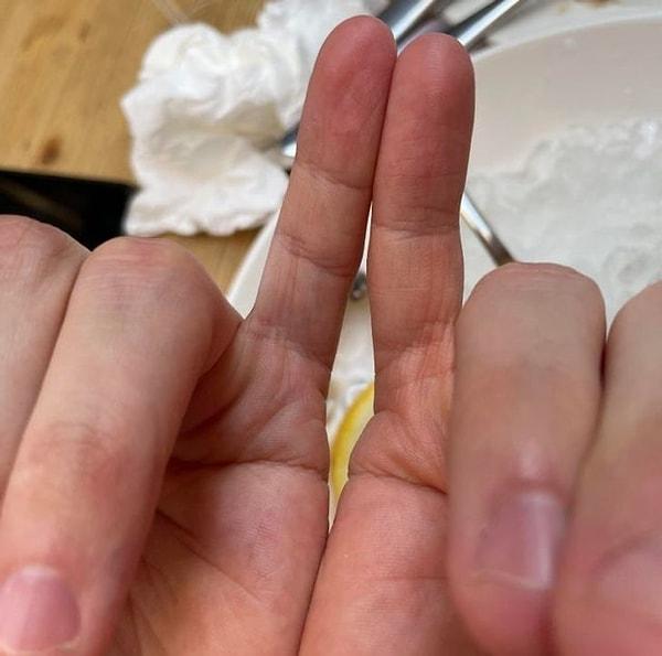 8. "30 yaşındaki arkadaşımın serçe parmağında tek eklemi olduğunu yeni fark etti."