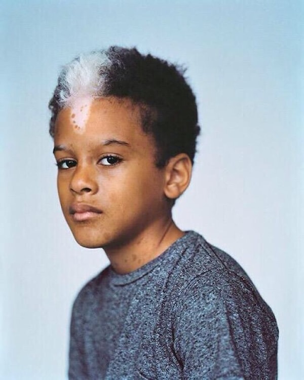 3. Одна из самых крутых родимых пятен, которые я когда-либо видел