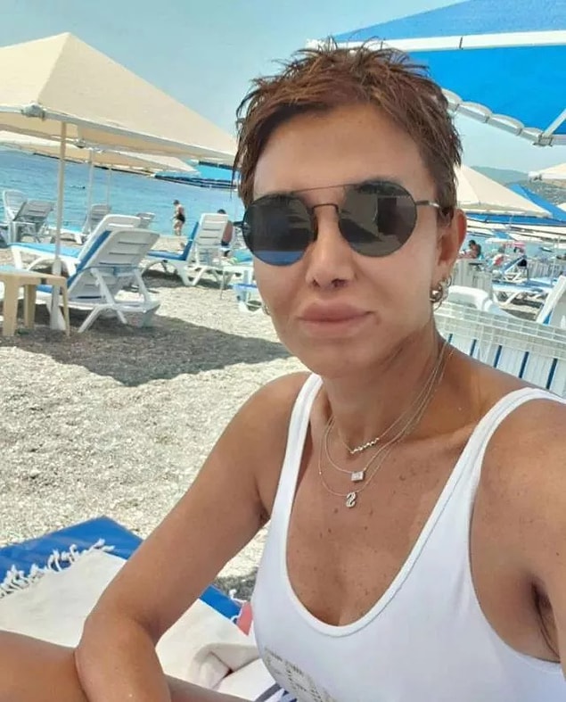 Aynı zamanda yüzüne de dolgu uygulatmıştı.