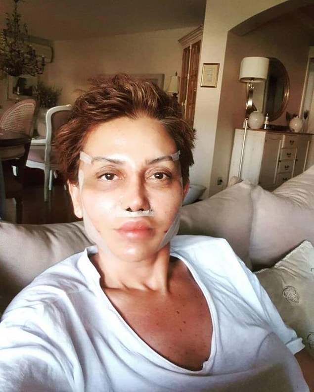 Ünlü sunucu akabinde Seda Sayan’ın doktoruna giderek Fransız Askısı ile yüzünü gerdirdi.