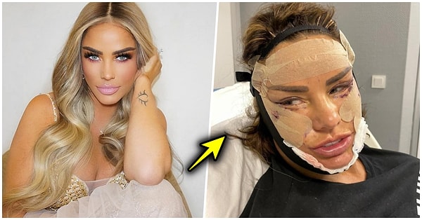 İngiliz şarkıcı, reality TV yıldızı ve eski model Katie Price, estetik ameliyatı için Türkiye'ye yeniden adım attı. 46 yaşındaki Price, altıncı yüz gerdirme operasyonunu gerçekleştirmek üzere cerrahi müdahaleye başvurdu.