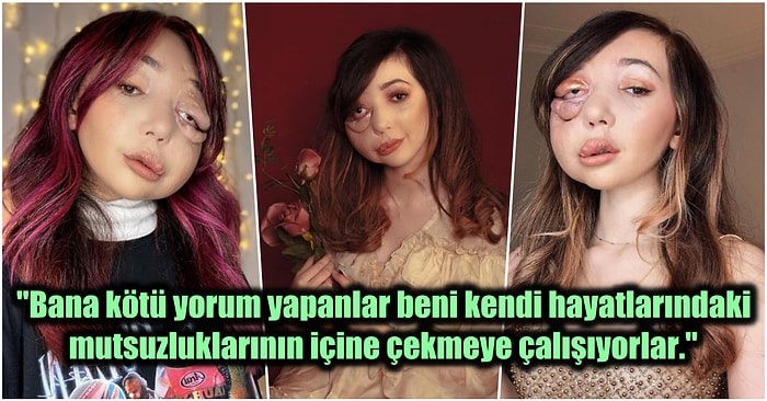 Hiçbir Hastalığın Başarılı ve Mutlu Bir Hayata Engel Olmadığını Gösteren Sosyal Medya Fenomeni: Nikki Lilly❤️