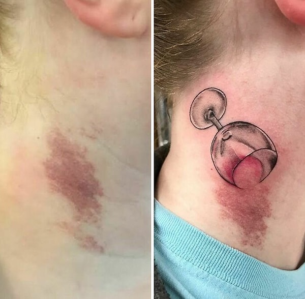 17. Для каждого родимого пятна можно найти идею