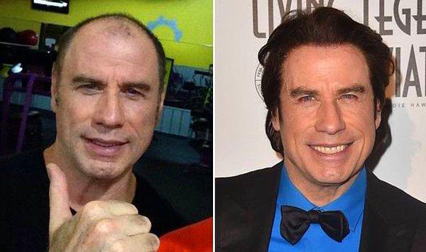 15. Müzikal filmlerin vazgeçilmez İtalyan kökenli oyuncu John Travolta'nın saç ektirme işlemi oldukça başarılı olmuş.