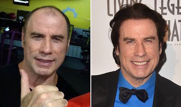 15. Müzikal filmlerin vazgeçilmez İtalyan kökenli oyuncu John Travolta'nın saç ektirme işlemi oldukça başarılı olmuş.