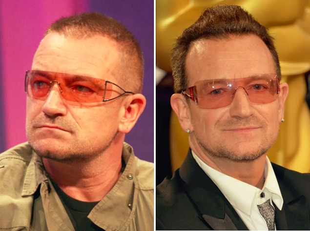 7. Müzikseverlerin favorilerinden rock grubu U2'nun solisti Bono da seyrelmeye başlayan saç problemini çözmüş.