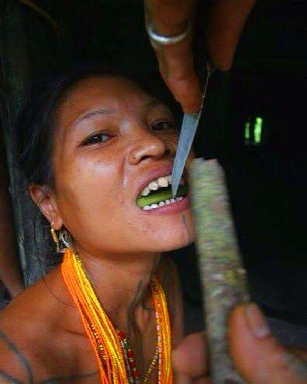 3. Diş törpüleme - Endonezya
