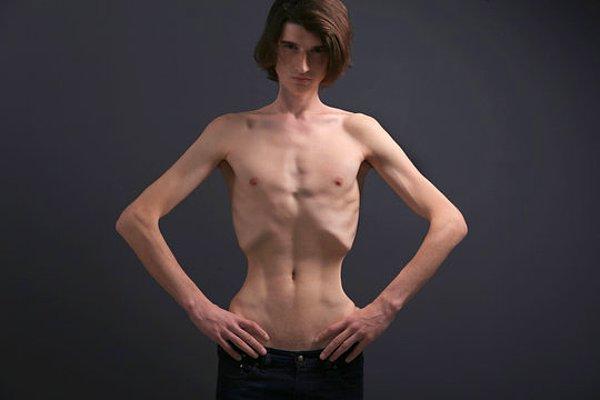 Anoreksiyanız olabilir!