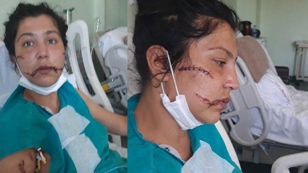 'Ben yaralıyken başımda sigara içti...'