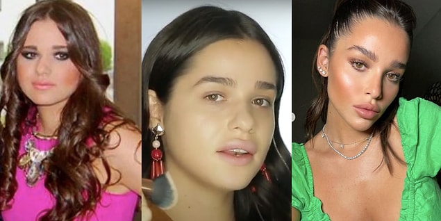 Son olarak, hiç bıçak altına yatmadığını iddia eden Ezgi Fındık'ın estetiksiz halini, ilk YouTube videosundaki halini ve Instagram'da paylaştığı son fotoğrafı birleştirdik. Yorumu size bırakıyoruz . :)