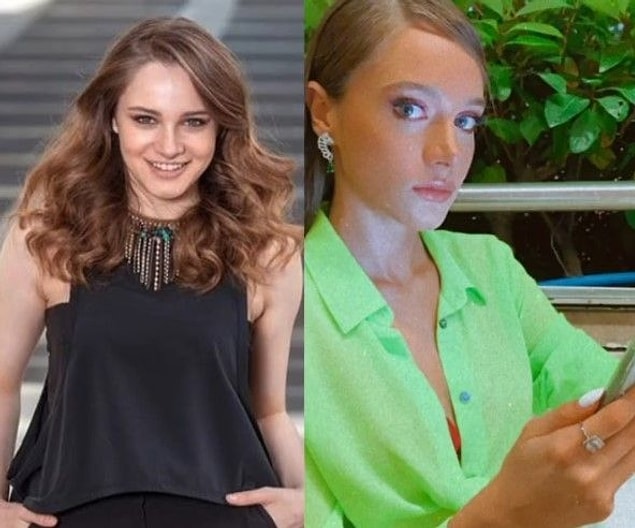 Miray Daner Estetik Yaptırdı mı?