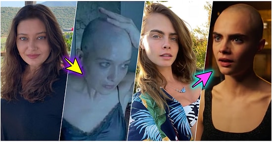 Bu Ne Cesaret! Rolleri İçin Saçlarını Kazıtmayı Kabul Eden Ünlüleri Açıklıyoruz