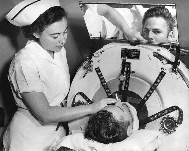 9. 1949 yılında St. Louis' St. Anthony's Hastanesi'nde yapay bir solunum cihazının içinde sigara içen adam: