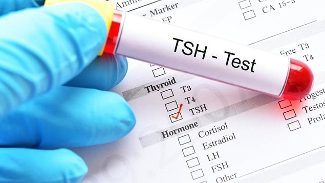 TSH Hormonu Yüksekliğinde Ne Tüketilmeli?