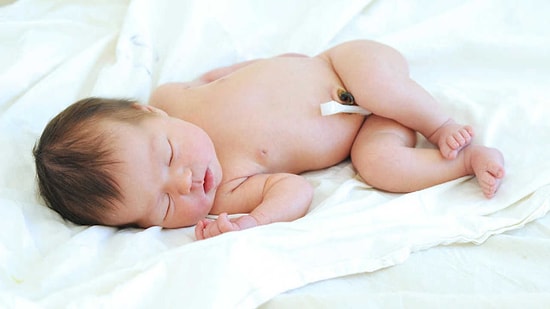 Göbek Kordonu Bakımı Nasıl Yapılır?