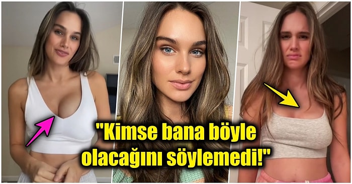 Doğum Yapmanın Hiç Bilmediğiniz Yüzü! Bebeğini Emzirirken Tek Memesi Şişip Büyüyen Genç Anne