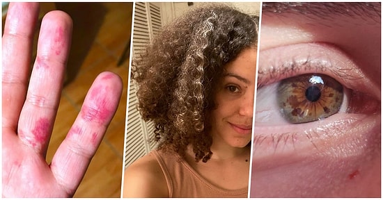 Vücutlarında Bulunan Benzersiz Özelliklerle Diğer İnsanlardan Farkını Ortaya Koymuş 15 Kişi