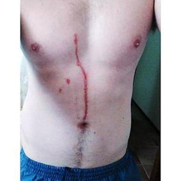 11. Avustralya'da yaşayan Dylan Maxwell'in midesine giren örümcek çıkarılmadan önce 3 gün boyunca canlı kalmıştır.