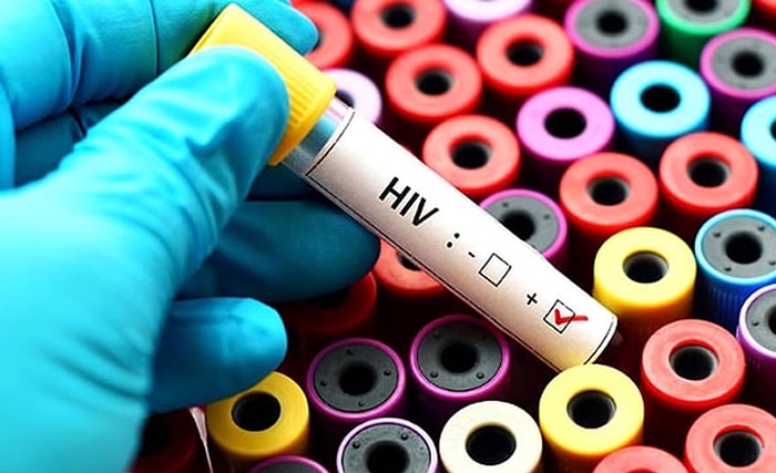 Mucize Gerçekleşti: Tedavi Görmeyen Kadın AIDS'i Yenen Dünyadaki İkinci Kişi Oldu