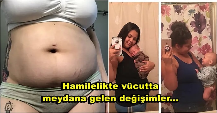 Yeni Annelerin Doğum Sonrasında Paylaştığı Vücutlarını Gördüğünüzde Kadınlara Bir Kez Daha Hayran Olacaksınız