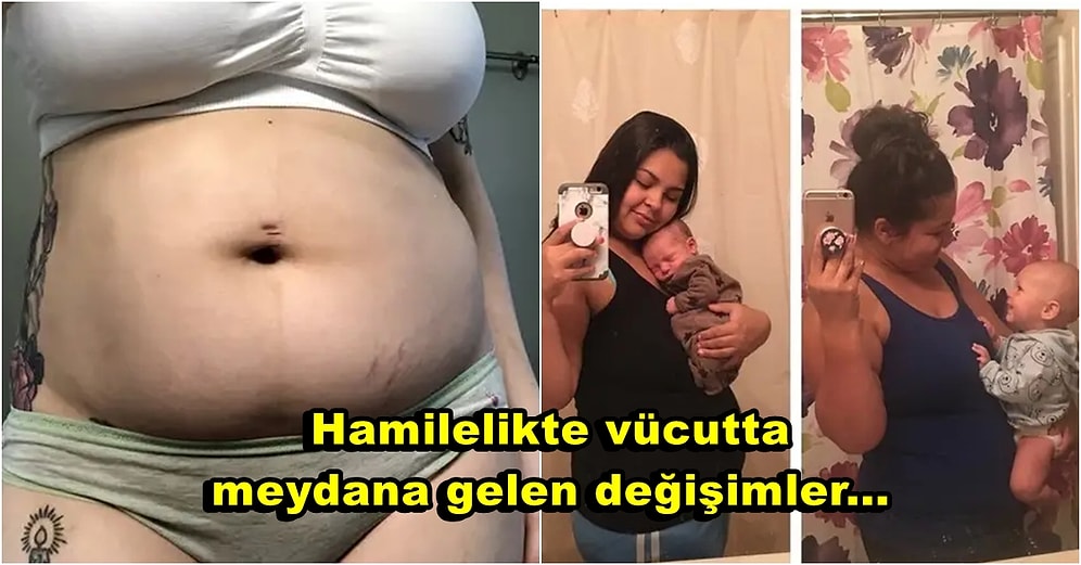 Yeni Annelerin Doğum Sonrasında Paylaştığı Vücutlarını Gördüğünüzde Kadınlara Bir Kez Daha Hayran Olacaksınız
