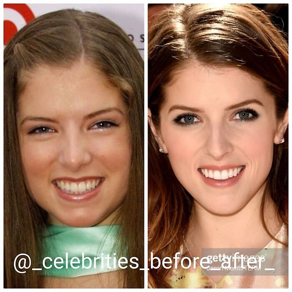 2. Анна Кендрик