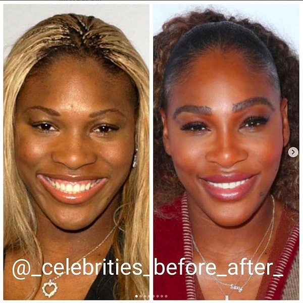 14. Серена Уильямс