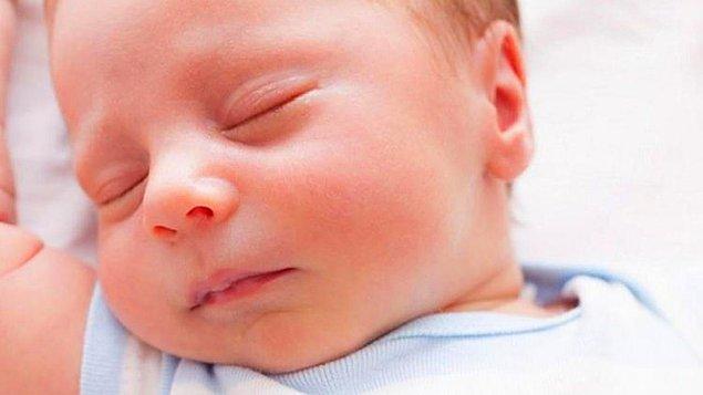 Bebeklerin Yüzündeki Kızarıklık Nasıl Geçer?