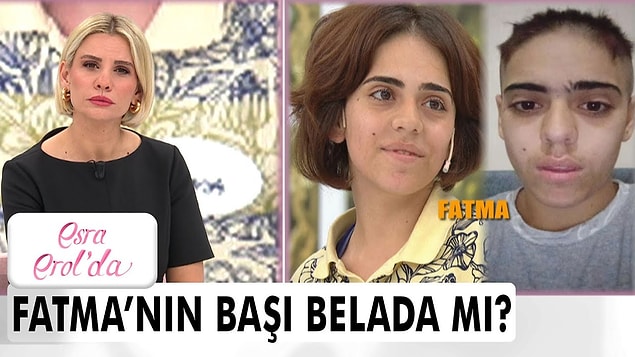 Baba evine döndükten sonra tekrar Ahmet'e kaçan Fatma'nın son hali içimizi parçaladı. Ahmet'in evindeyken Fatma'nın saçlarını kazıdıkları ortaya çıktı.