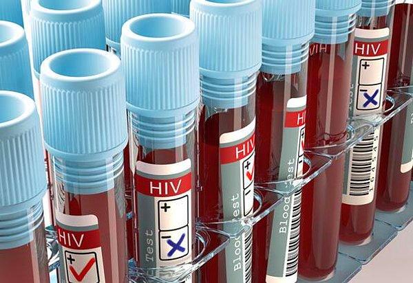 HIV'e karşı da bireyler belli aralıklarla HIV testi yaptırarak ve cinsel ilişki sırasında prezervatif ve oral bariyerler kullanarak korunabilir. HIV+ olmaları aktif bir cinsel yaşamları olmayacağı anlamına gelmiyor elbette.