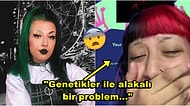 Aman Dikkat! Kulağına Yaptırdığı Piercingler Sonrası Kulağında Sert Dokular Çıkan Kadının Yaşadığı Şok
