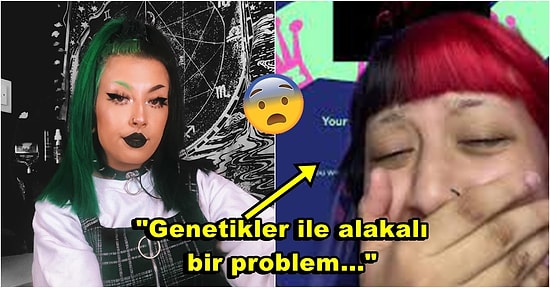 Aman Dikkat! Kulağına Yaptırdığı Piercingler Sonrası Kulağında Sert Dokular Çıkan Kadının Yaşadığı Şok