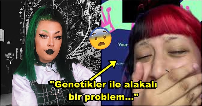 Aman Dikkat! Kulağına Yaptırdığı Piercingler Sonrası Kulağında Sert Dokular Çıkan Kadının Yaşadığı Şok