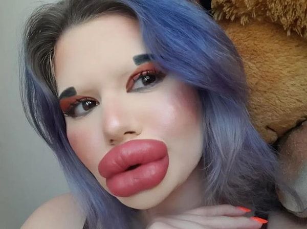 Было отмечено, что стоимость операции составила около 600 евро.