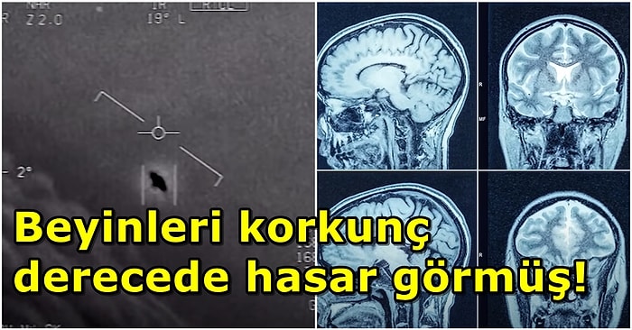 Şok Eden Araştırma! UFO'larla Karşılaştığını İddia Eden Pilotların Beyinlerinin Hasar Gördüğü Tespit Edildi