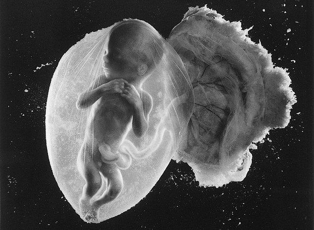 Cambridge Üniversitesi araştırmacıları, bazı bebeklerin rahimde neden düzgün bir şekilde büyümek için mücadele ettiğini araştırırken bazı bulgular elde etti.