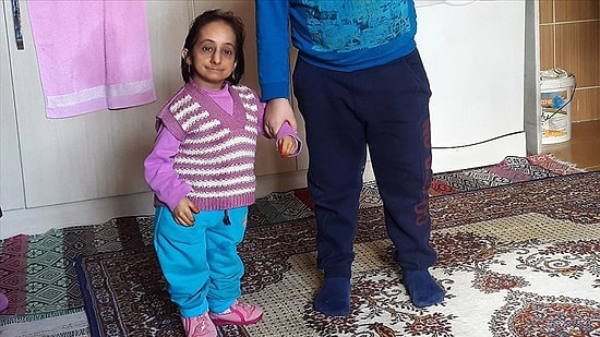 72 Santimetrelik Boyuyla Türkiye'nin En Kısa Kadınıydı... Elif Kocaman Hayatını Kaybetti