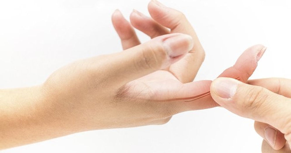 Parmak Şişmesine Hangi Bölüm/Doktor Bakar?