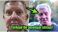 11 Bin Euro Harcadığı Estetik Ameliyatının Ardından Uyuyabilmek İçin Gözlerini Bantlamak Zorunda Kalan Adam