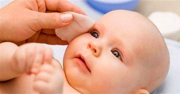 Bebeklerde Göz Çapaklanmasının Nedenleri...
