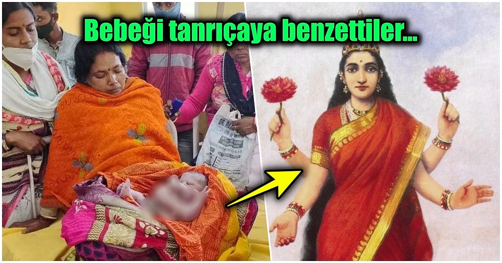 Daha Neler Göreceğiz? Hindistan'da Dört Kol ve Dört Bacakla Dünyaya Gelen Bebek Görenleri Şaşırttı