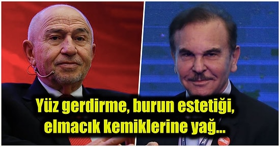 TFF Başkanı, Holding Yöneticileri... Türkiye’nin En Ünlü Patronlarının Yaptırdıkları İddia Edilen Estetikler