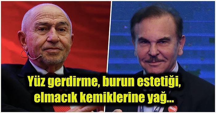 TFF Başkanı, Holding Yöneticileri... Türkiye’nin En Ünlü Patronlarının Yaptırdıkları İddia Edilen Estetikler